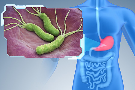 微需氧PyloriHelicobacterPylori是胃部发现的一种格外阴设计图片