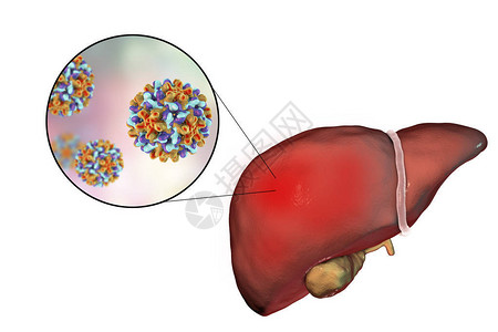 性传播肝炎B感染的肝热和对乙型肝炎的近插画