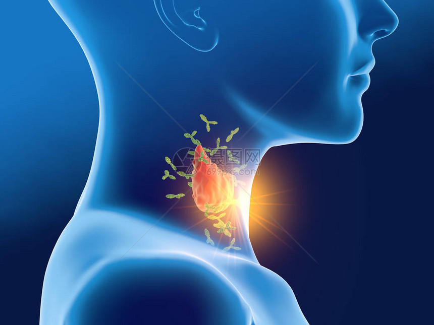 医学3D图例显示抗体攻击妇女甲图片