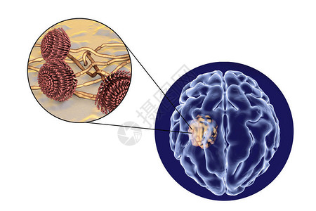 足菌肿脑曲霉菌和真菌曲霉菌的特写视图设计图片