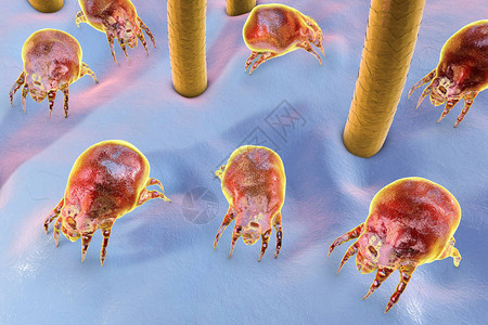 除螨虫用毛发和寄生在灰尘和家具中的寄生虫设计图片