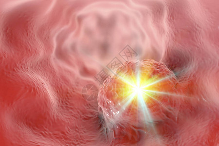 食管癌治疗概念3D插图背景图片
