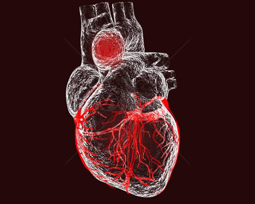 升主动脉瘤黑色背景下孤立的主动脉瘤心脏图片