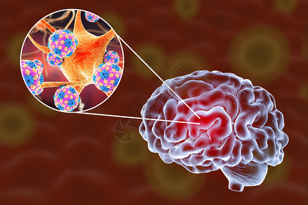 三皇寨3D插图显示大脑和突变神经元设计图片