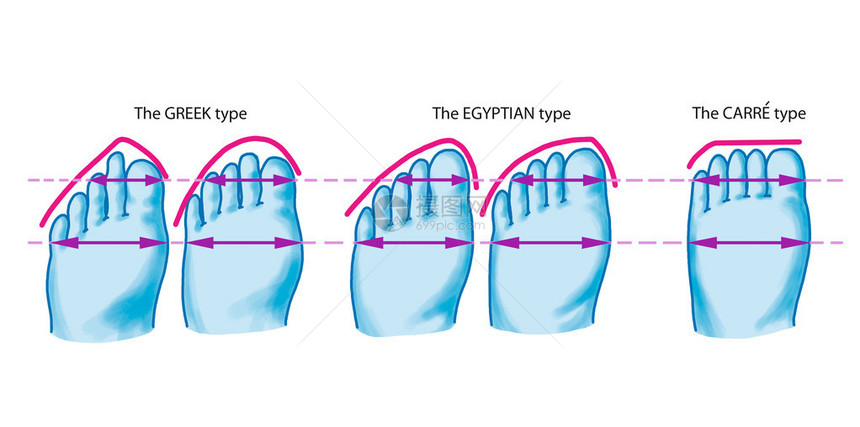 三种脚型希腊式埃及式方形卡雷式前脚掌和脚趾图片