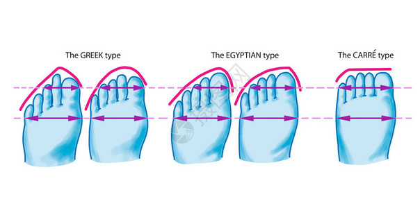 三种脚型希腊式埃及式方形卡雷式前脚掌和脚趾高清图片