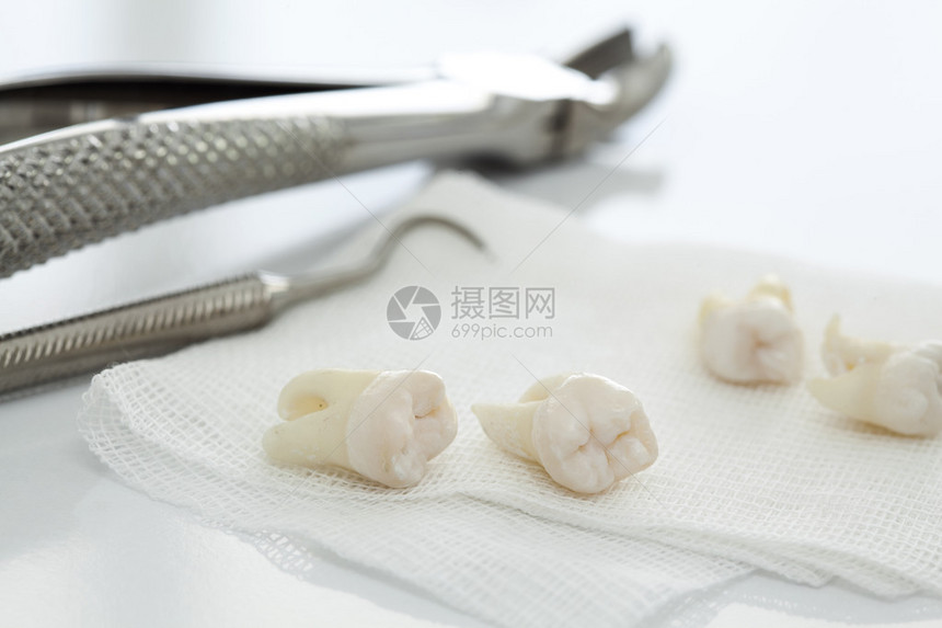 牙科工具和被移除的牙齿图片
