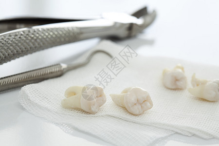 牙科工具和被移除的牙齿图片