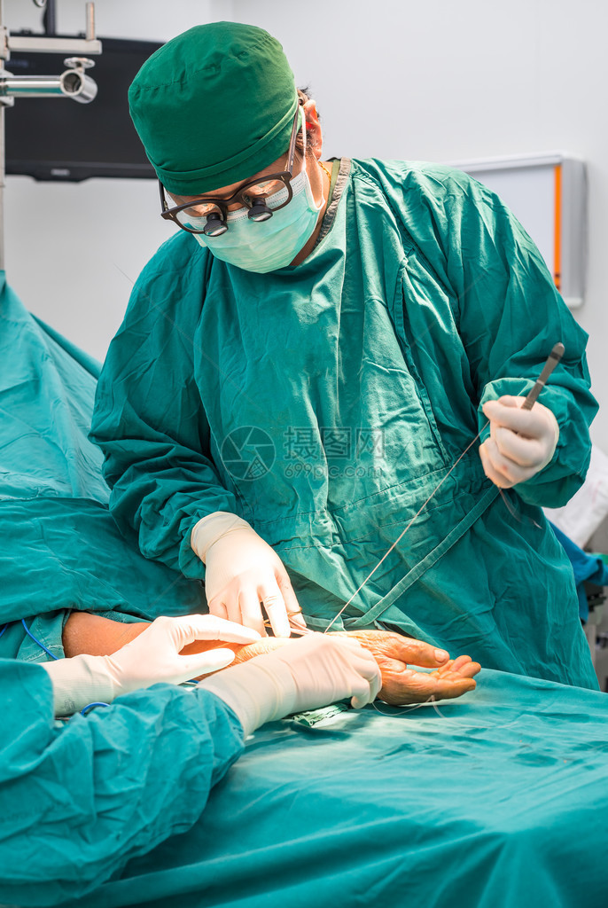 手术外科手术动血管瘘长期透析用于结束图片