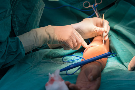 动静脉做手术的年轻女外科医生背景