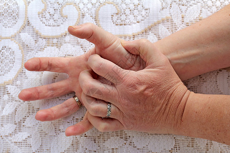 一位患有帕金森病的女人握着她的手摇晃图片