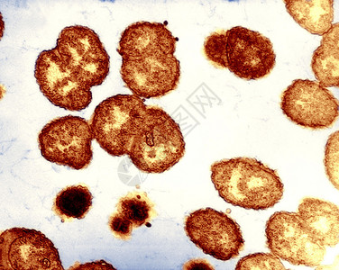 双球菌细菌是淋病的原体背景