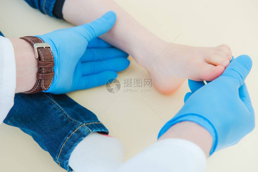 儿童关节脱位或脱位治愈足部医生用蓝色医用手套检图片