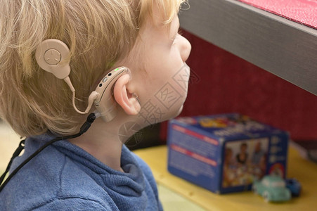 一个有听力助听器和科克利尔植高清图片