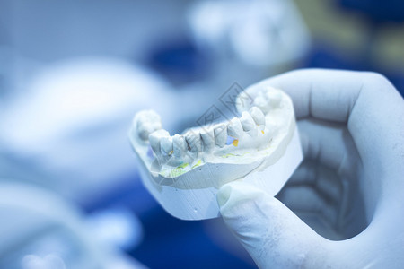 显示牙科诊所病人牙齿衰减的假牙医粘土牙板图片