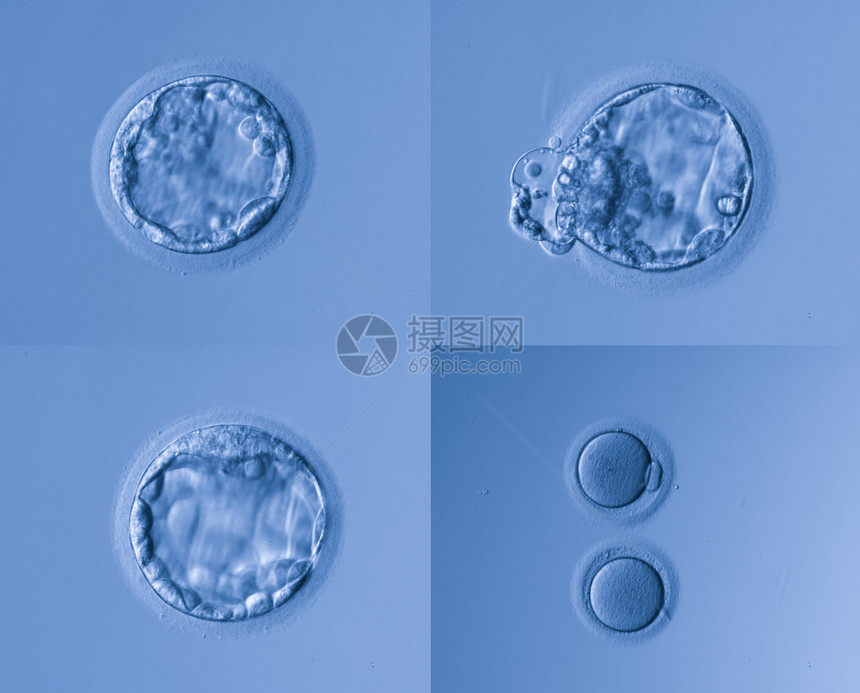 人工受精图片