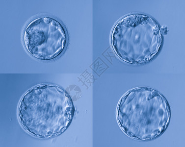 人工受精图片