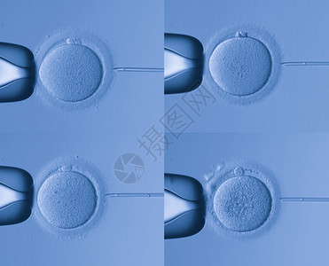 人工受精图片