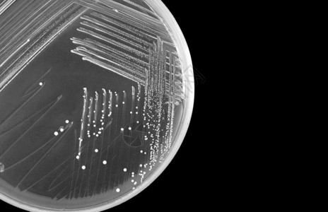 黑色背景中分离的培养皿上的细菌宏概念科学研究或科学教图片
