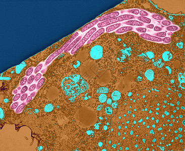 显微镜下的变形菌高清图片
