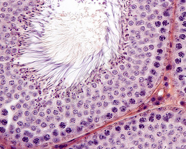 雄生发上皮显示精原细胞减数分裂中的精母细胞图片