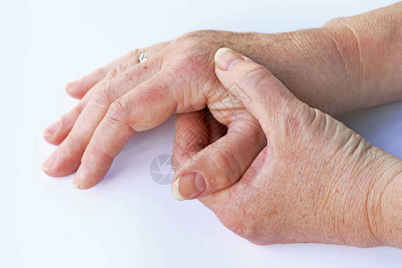 一名年长妇女手部疼痛高清图片