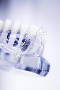 牙医齿塑料模型用于牙科诊所的教学习和患者咨询图片