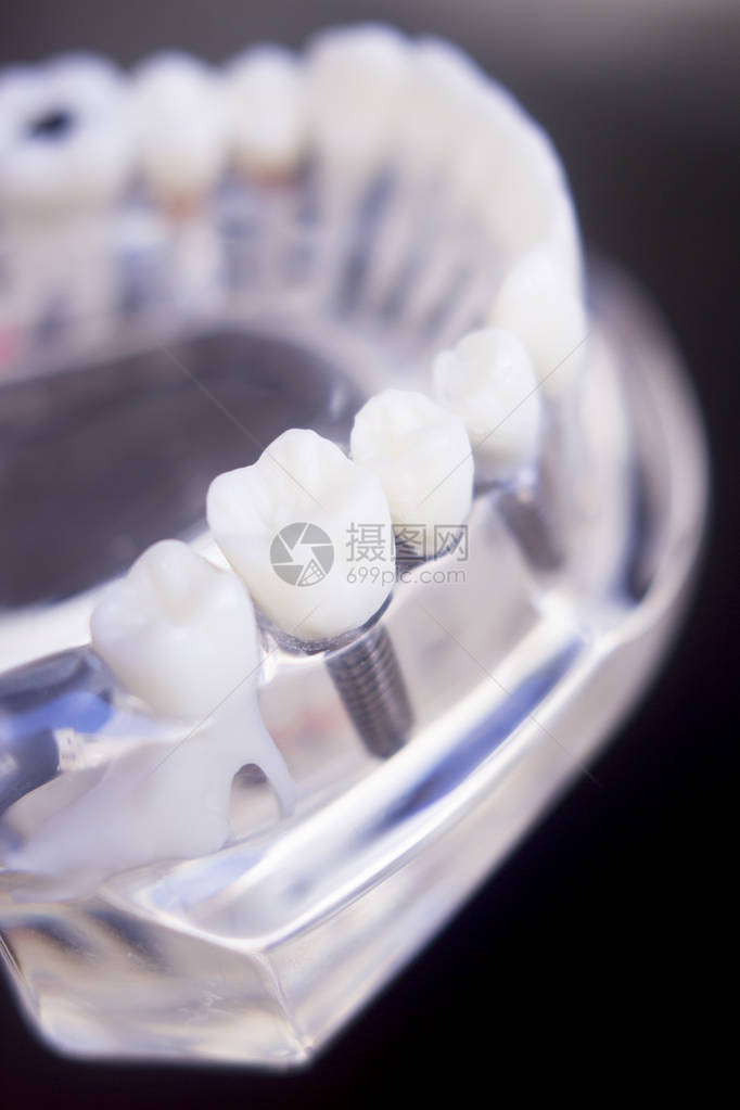 牙医齿塑料模型用于牙科诊所的教和患者咨询图片