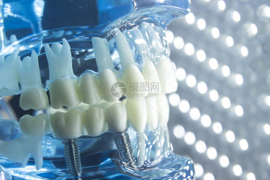牙医齿教学模型显示每颗牙齿牙龈牙根植入物腐烂牙图片