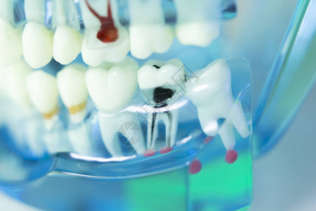 牙科齿口腔口香糖牙医教学模型图片