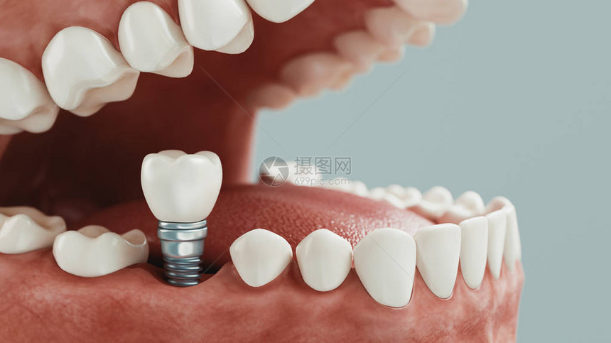 牙科护理3d渲染图片
