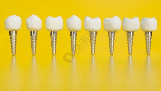 人工植牙人类牙齿或假牙在黄色背景图片