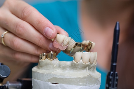 牙科实验室的人造牙图片