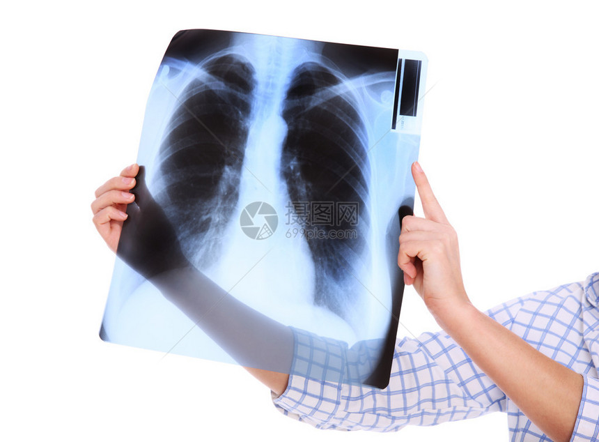 在白色背景的肺部x射线图片图片