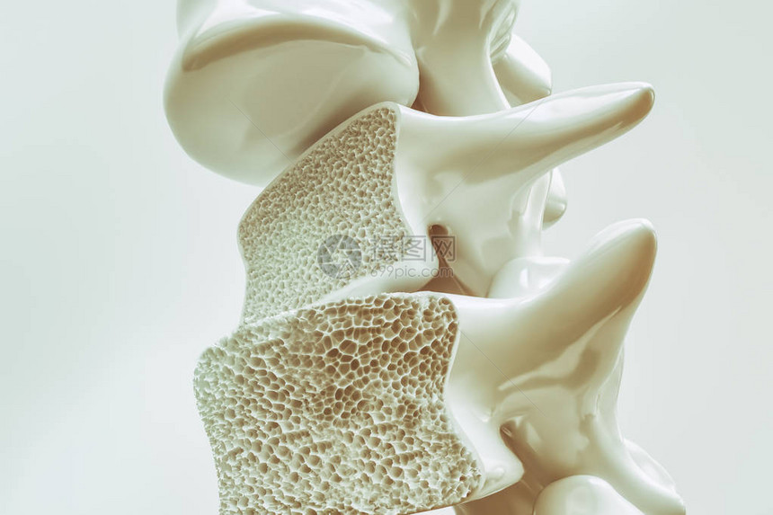 脊柱骨质疏松症3d渲染图片