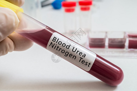 手握血液测试管用于血液Urea氮图片