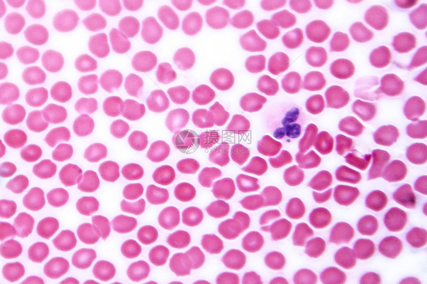 显微镜下的人类血迹显示红血细胞和中微图片