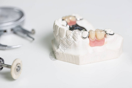 牙科化验室内人工沉积图片