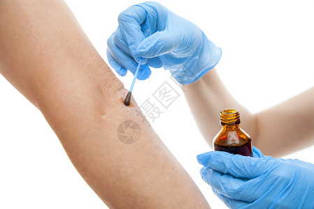护士用碘溶液涂抹手臂图片