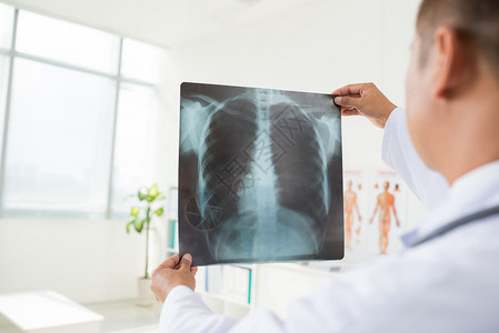 男放射学家在看肺部射线摄影图片