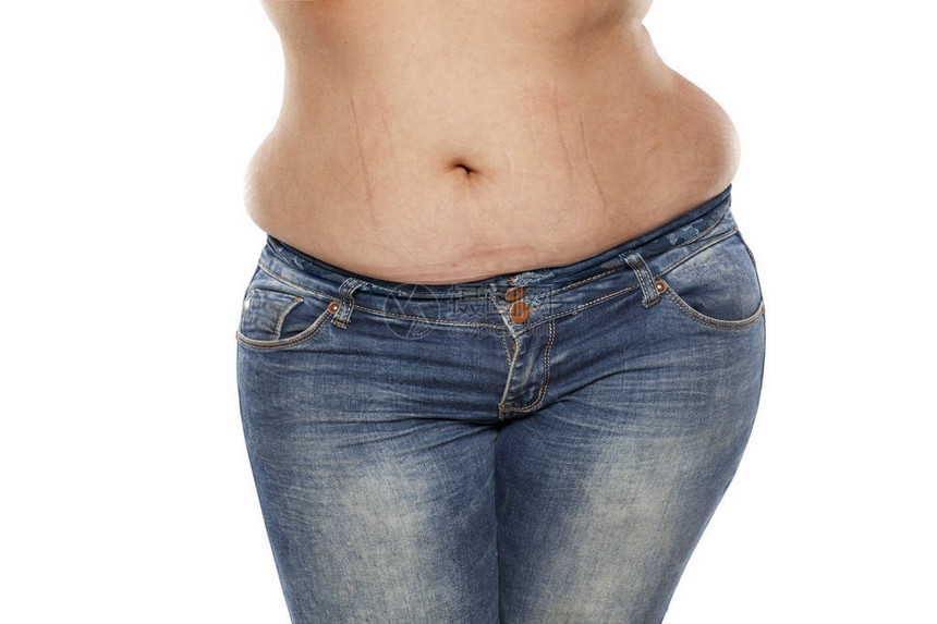 白底牛仔裤的胖女人肚子上有妊娠纹图片
