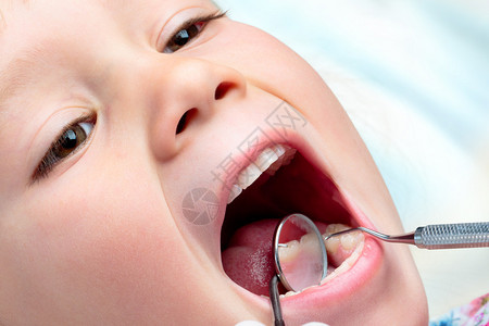 婴儿口腔检查非常接近嘴部和口镜在张开图片