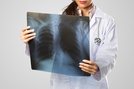 女医生看肺部的x射线照片图片
