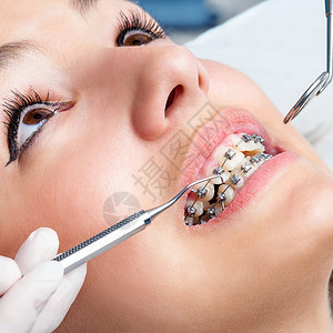 用和口镜在牙套上工作的人手非常接近将显示牙套的雌嘴图片