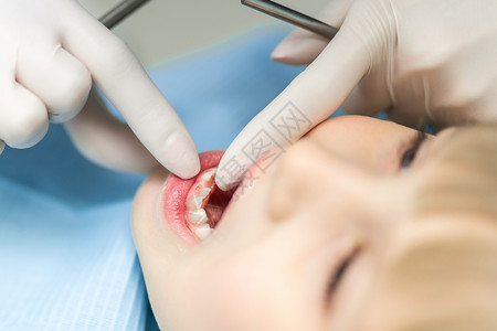 特写牙医手显示乳牙和臼齿用恒牙替换乳牙齿掉了一个洞儿背景图片