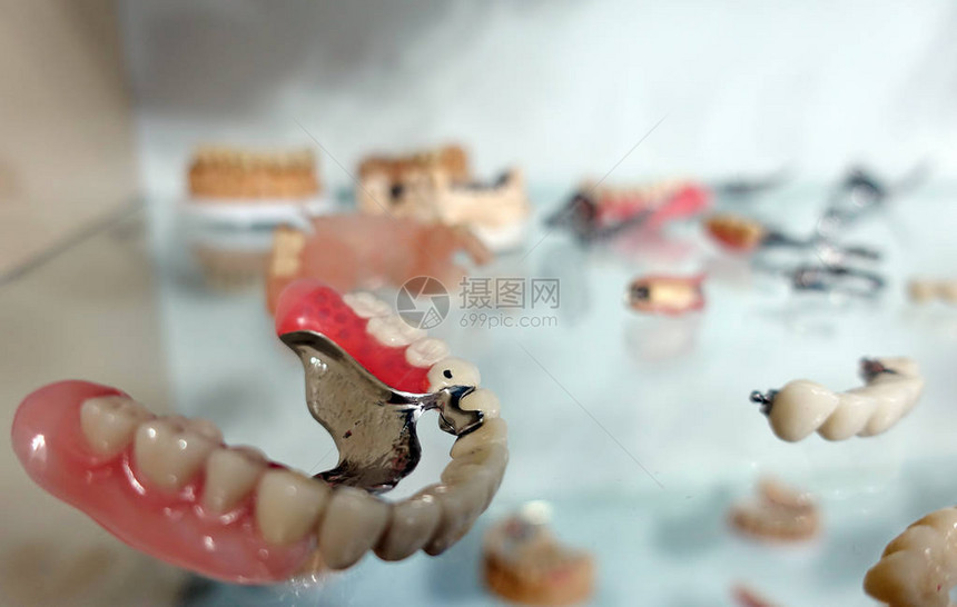 牙医的牙齿瓷修复体图片