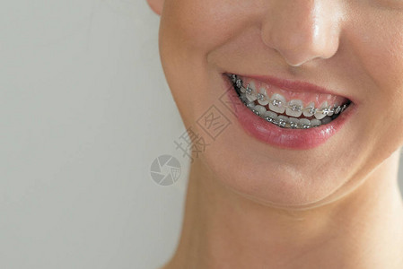 女微笑露出牙齿的蓝牙套紧贴着图片