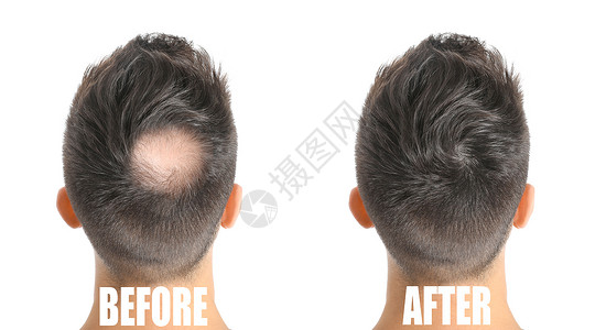 白种背景的染发前和后图片