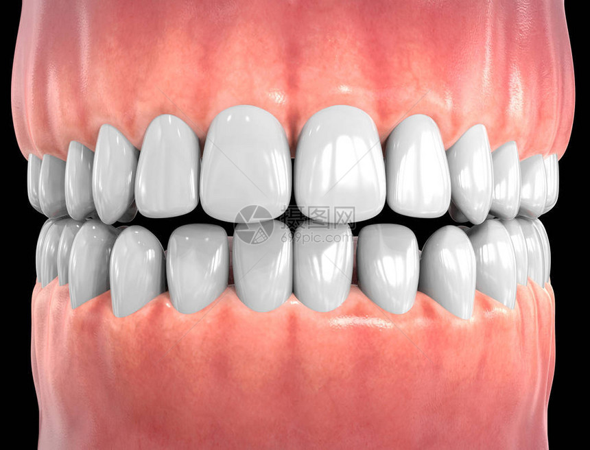 3D单独牙齒牙图片