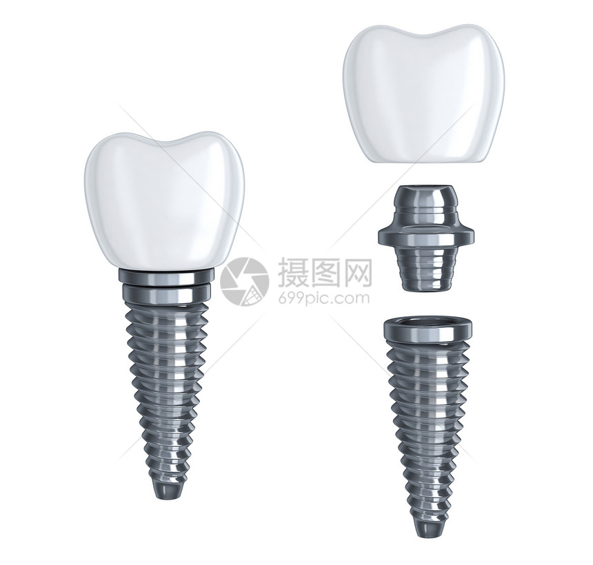 在孤立的白背景上拆散的牙齿植入器图片